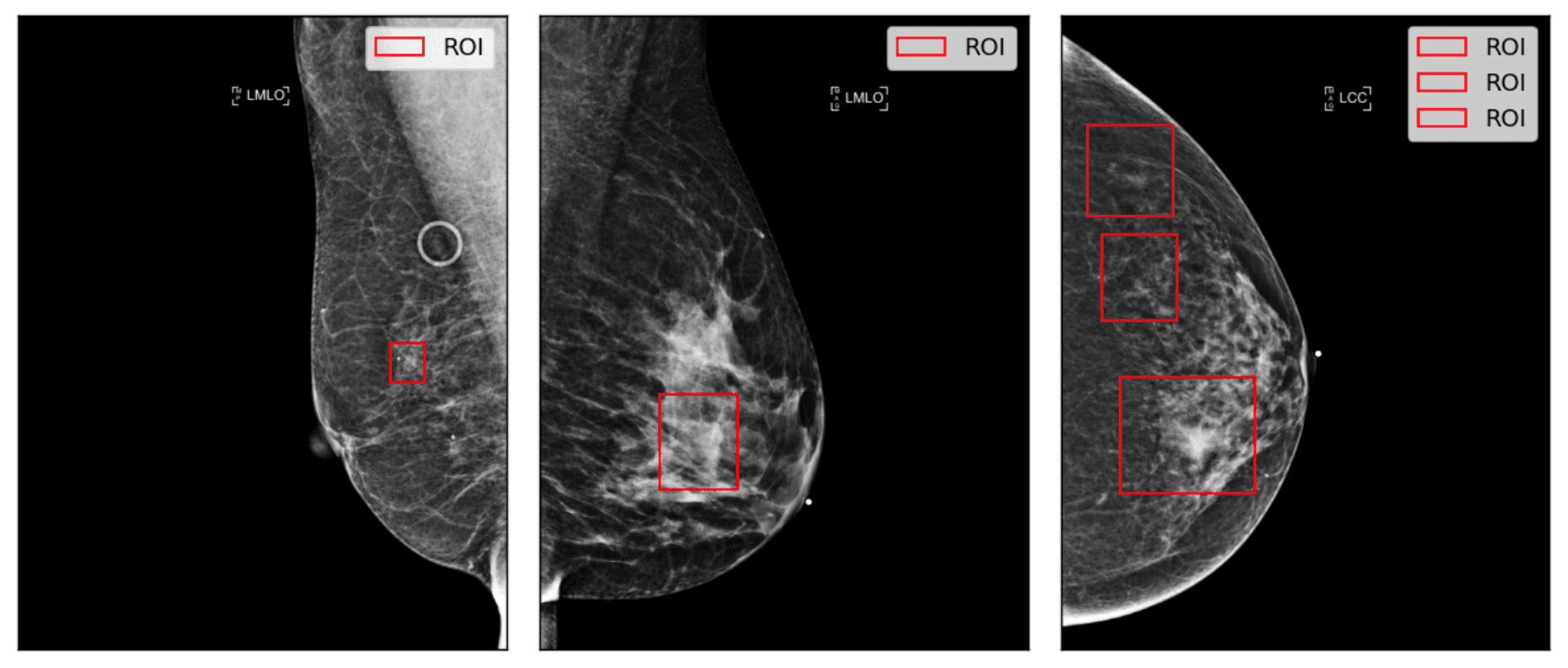 Example of ROI visualizations on source images