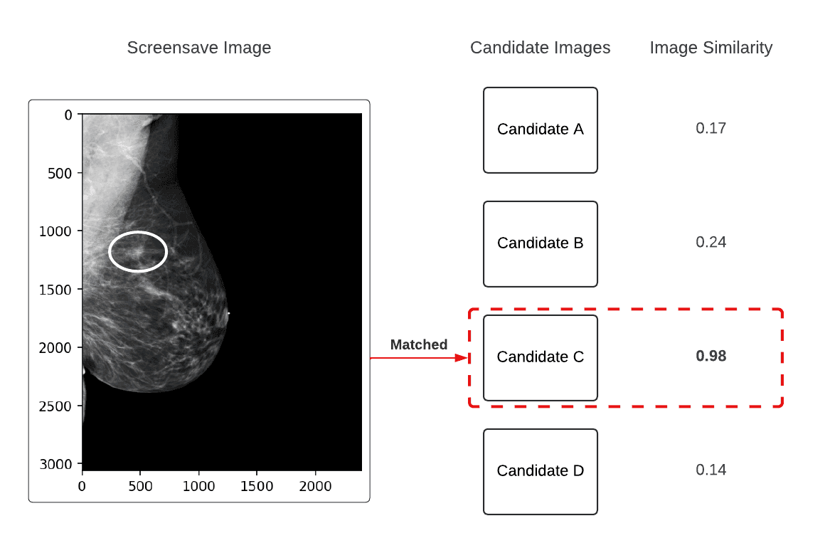 Example of the SSC-to-DICOM matching process