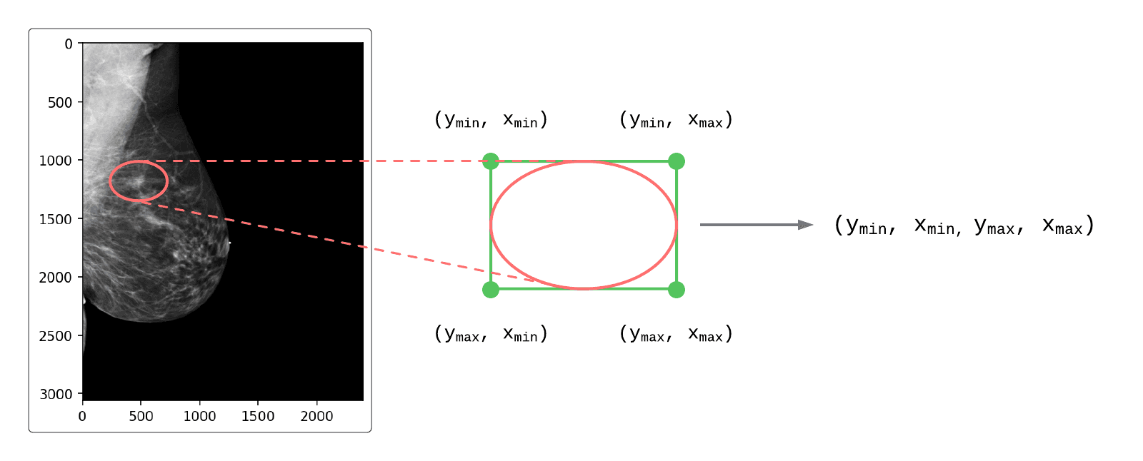 Mapping elliptical ROI coordinates to rectangular coordinates